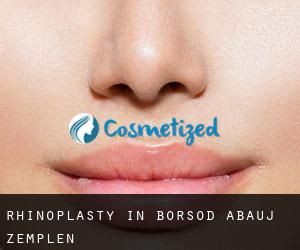 Rhinoplasty in Borsod-Abaúj-Zemplén