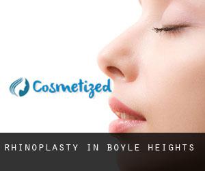 Rhinoplasty in Boyle Heights