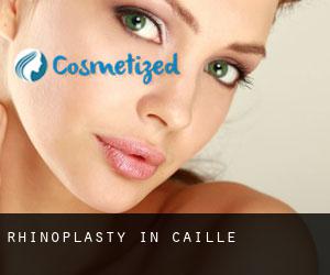 Rhinoplasty in Caille