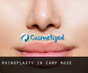 Rhinoplasty in Camp Rose