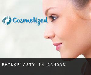 Rhinoplasty in Canoas