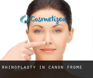 Rhinoplasty in Canon Frome