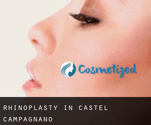 Rhinoplasty in Castel Campagnano