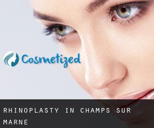 Rhinoplasty in Champs-sur-Marne
