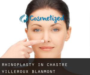 Rhinoplasty in Chastre-Villeroux-Blanmont