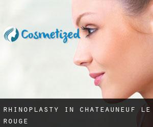 Rhinoplasty in Châteauneuf-le-Rouge