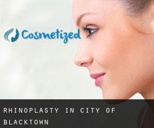 Rhinoplasty in City of Blacktown