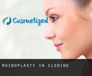 Rhinoplasty in Clodine