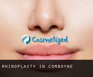 Rhinoplasty in Comboyne Rhinoplasty in Comboyne