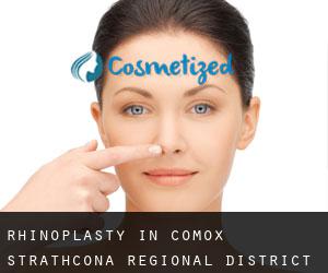 Rhinoplasty in Comox-Strathcona Regional District