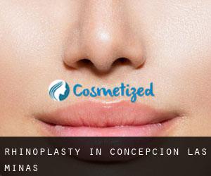 Rhinoplasty in Concepción Las Minas Rhinoplasty in Concepción Las Minas