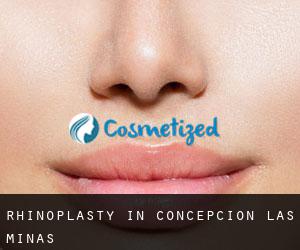 Rhinoplasty in Concepción Las Minas