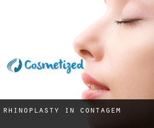 Rhinoplasty in Contagem