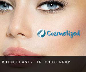 Rhinoplasty in Cookernup