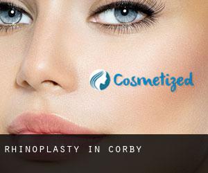 Rhinoplasty in Corby Rhinoplasty in Corby