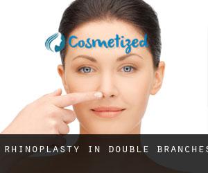 Rhinoplasty in Double Branches