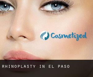 Rhinoplasty in El Paso