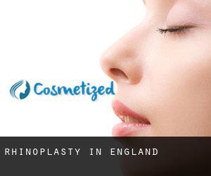 Rhinoplasty in England Rhinoplasty in England
