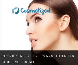 Rhinoplasty in Evans Heights Housing Project