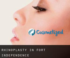 Rhinoplasty in Fort Independence