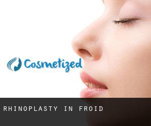 Rhinoplasty in Froid