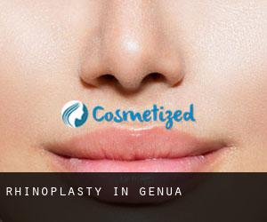 Rhinoplasty in Genua Rhinoplasty in Genua