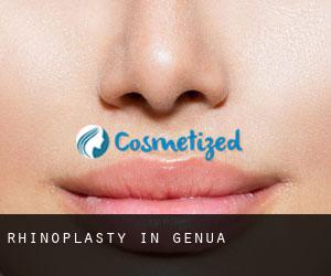 Rhinoplasty in Genua