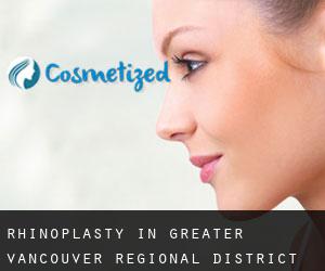 Rhinoplasty in Greater Vancouver Regional District