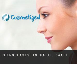 Rhinoplasty in Halle (Saale) Rhinoplasty in Halle (Saale)