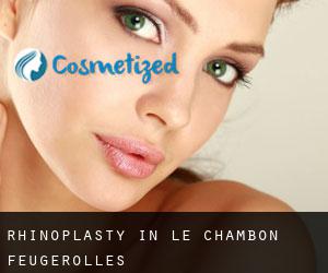Rhinoplasty in Le Chambon-Feugerolles