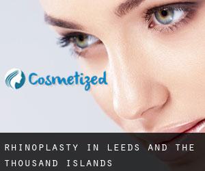 Rhinoplasty in Leeds and the Thousand Islands