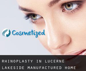 Rhinoplasty in Lucerne Lakeside Manufactured Home Community
