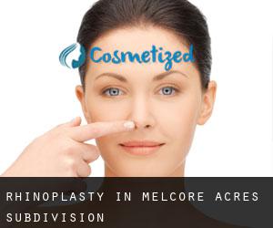 Rhinoplasty in Melcore Acres Subdivision