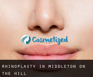 Rhinoplasty in Middleton on the Hill