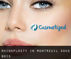 Rhinoplasty in Montreuil-sous-Bois