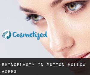 Rhinoplasty in Mutton Hollow Acres