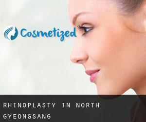 Rhinoplasty in North Gyeongsang