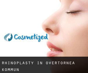Rhinoplasty in Övertorneå Kommun Rhinoplasty in Övertorneå Kommun