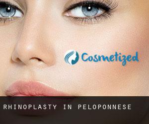 Rhinoplasty in Peloponnese