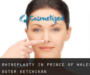 Rhinoplasty in Prince of Wales-Outer Ketchikan