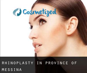 Rhinoplasty in Province of Messina