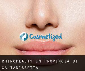 Rhinoplasty in Provincia di Caltanissetta
