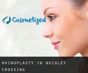 Rhinoplasty in Quigley Crossing