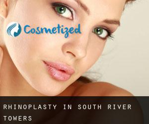 Rhinoplasty in South River Towers