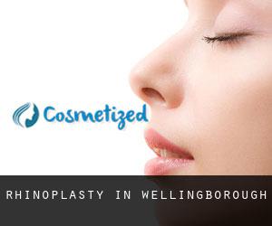 Rhinoplasty in Wellingborough