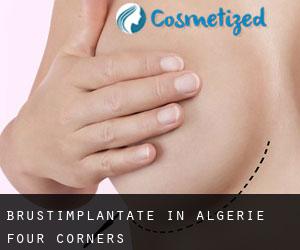 Brustimplantate in Algerie Four Corners