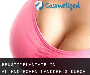 Brustimplantate in Altenkirchen Landkreis durch metropole - Seite 1