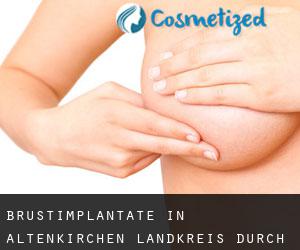 Brustimplantate in Altenkirchen Landkreis durch metropole - Seite 2