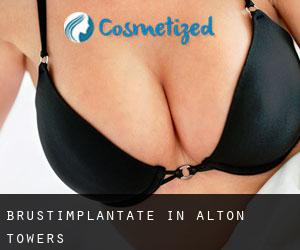 Brustimplantate in Alton Towers