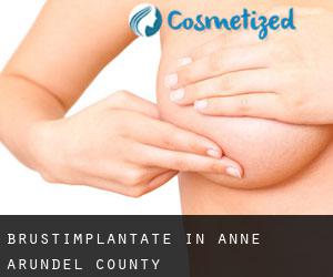 Brustimplantate in Anne Arundel County